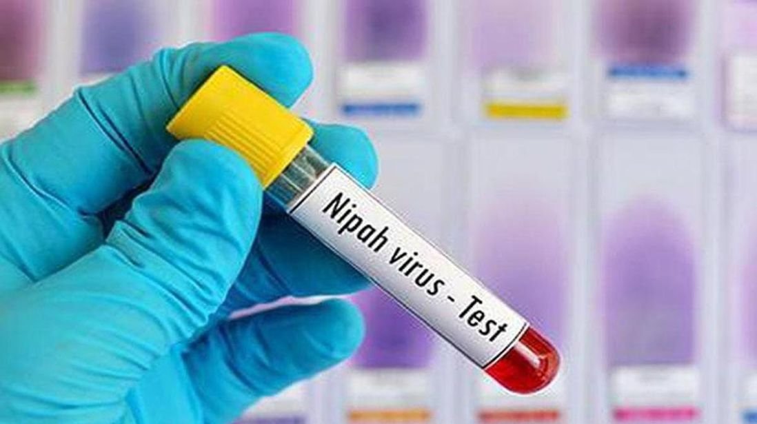 மலேசியாவில் நிபா வைரஸ்  இல்லை -கால்நடை சேவைகள் துறை